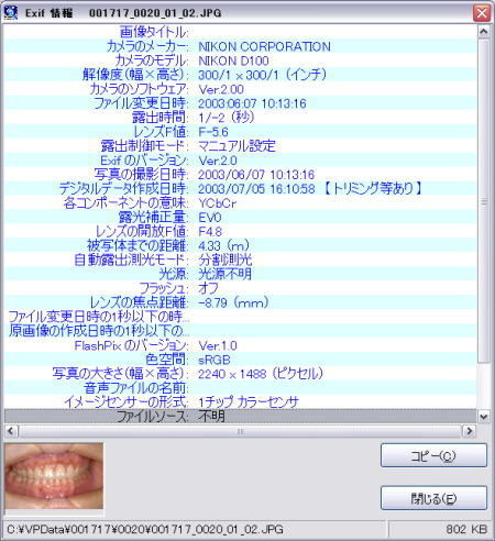 歯科インフォームドコンセント用デジタル画像管理ソフト VPシステム Exif表示機能