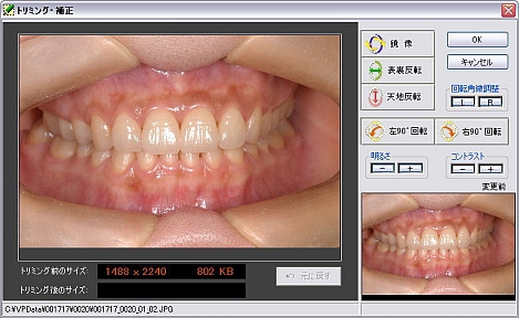 歯科インフォームドコンセント用デジタル画像管理ソフト VPシステム 画面のトリミング、修正画面